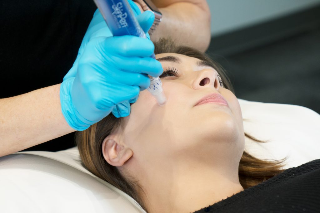 PRP Facial/Microneedling